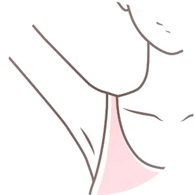 多汗症（脇・手のひらなど）